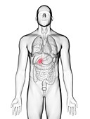 Illustration of a man's gallbladder