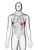 Illustration of a man's spleen