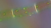 Amoeba and strand of alga, light microscopy footage