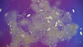 Coleps ciliate protozoa feeding, light microscopy footage