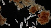 Paramecium protozoa and debris, light microscopy footage