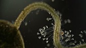 Vorticella protozoa, light microscopy footage
