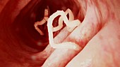 Tapeworm in the intestines, animation