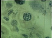 Chromosome microscopy