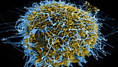 Ebola virus