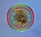 Protozoa, Arcella sp., LM