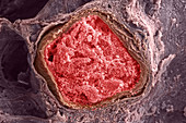 Human Lung, SEM