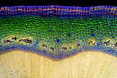 Forsythia Plant Tissue, Polarized LM