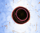 Bacterial Cell, TEM