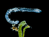 Freshwater worm (Chaetogaster diastrophus), LM