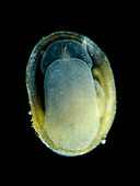 Fresh water snail (Ancylus sp.), LM