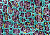 Myenteric Plexus, SEM