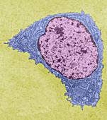 Chondrocyte, TEM