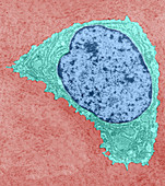 Chondrocyte, TEM