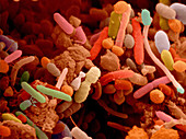 Bacteria in human faeces, SEM