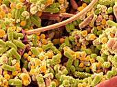 Bacteria in Human Tonsil Pus, SEM