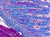 Developing Bone, LM