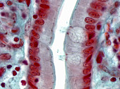 Mucosal Epithelial Cells, LM