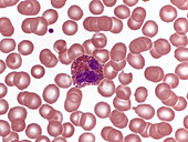 Red and White Blood Cells, LM