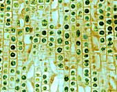 Hyacinth Root Tip Cells
