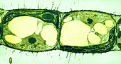 Algae Cell Division, Cylindrocapsa brebissonii