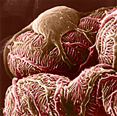 Kidney Glomerulus, SEM