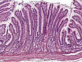 Pyloric Stomach Mucosa, LM