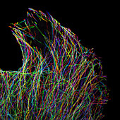 Microtubule Tip-biding Protein EB3