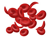 Sickle Cells, Illustration