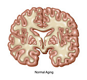Normal Aging Brain