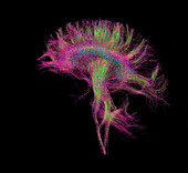 Brain, Fibre Tractography Image