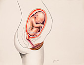 Pregnancy, Foetus at 7 Months, 7 of 9
