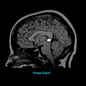 Pineal Gland, Sagittal MRI