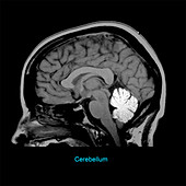 Cerebellum, Sagittal MRI