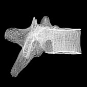 Human Vertebra T5, X-ray