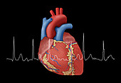 Atrial Fibrillation with EKG, Illustration