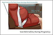 Seat Belt Safety during Pregnancy, Illustration