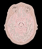Brain Scan Slice, Illustration