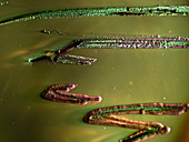 E. coli in culture dish, macro image
