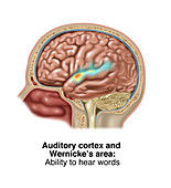 Auditory Cortex and Wernicke's Area, Illustration