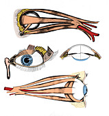 Muscles of Eye, Illustration