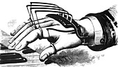 Atkins' Finger-Supporting Device, 1881