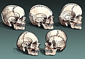 Normal and Abnormal Skulls, 16th Century
