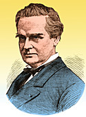 J. Marion Sims, Father of American Gynecology