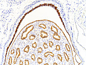 Kidney, medulla, LM