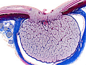 Optic disk and optic nerve, LM