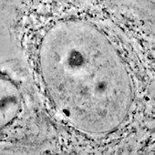 Human fibroblast nucleus