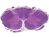 Spinal cord, human, LM
