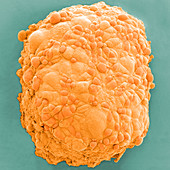 Mesothelioma Spheroid, SEM