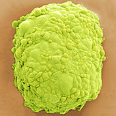 Mesothelioma Spheroid, SEM